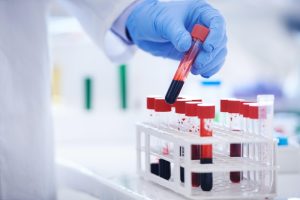 اهمیت آزمایشات قبل از ازدواج: پیشگیری از بیماری‌ ها و آگاهی از سلامت