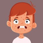 زنگ خطر شیوع سرخک در استان یزد: لزوم توجه به واکسیناسیون