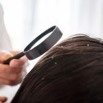 علت خشکی پوست و شوره سر چیست؟ بررسی نقش ویتامین‌ها در سلامت پوست و مو