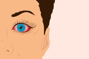 عوارض چشمی کرونا: اهمیت توجه به علائم چشمی در بیماران مبتلا به کووید-19