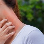 اگزما و درماتیت: راهکارهای پیشگیری و مدیریت علائم در فصل بهار