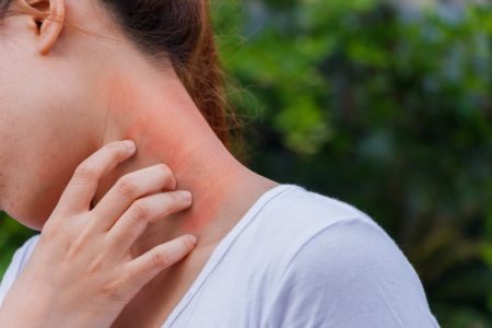 اگزما و درماتیت: راهکارهای پیشگیری و مدیریت علائم در فصل بهار