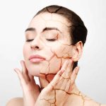 دلایل پنهان خشکی پوست و راه‌ های مقابله با آن