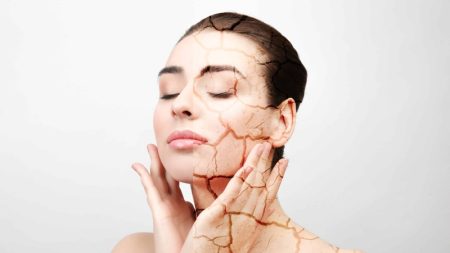 دلایل پنهان خشکی پوست و راه‌ های مقابله با آن