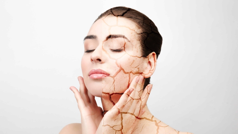 دلایل پنهان خشکی پوست و راه‌ های مقابله با آن