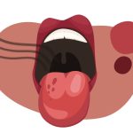 علت تلخی دهان چیست؟ دلیل طعم تلخ دهان هنگام صبح یا ناشتا