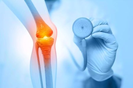 نشانه‌ های اولیه آرتروز: چگونه از پیشرفت آن جلوگیری کنیم