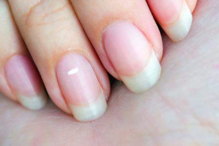 چرا ناخن‌ ها سفید میشوند؟ علت لکه‌ های سفید روی ناخن