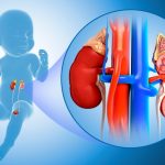 علائم پنهان بیماری‌ های کلیه در کودکان و راهکارهای پیشگیری