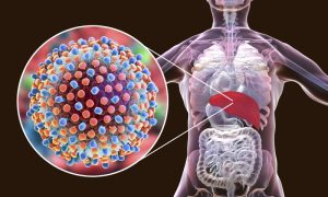 حذف هپاتیت C تا سه سال آینده؛ علائم، راه‌ های انتقال و برنامه‌ های پیشگیری