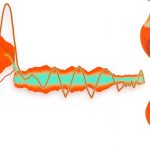 ساخت ربات زیستی ۲.۷ میلی‌ متری برای بازسازی تارهای صوتی آسیب‌ دیده