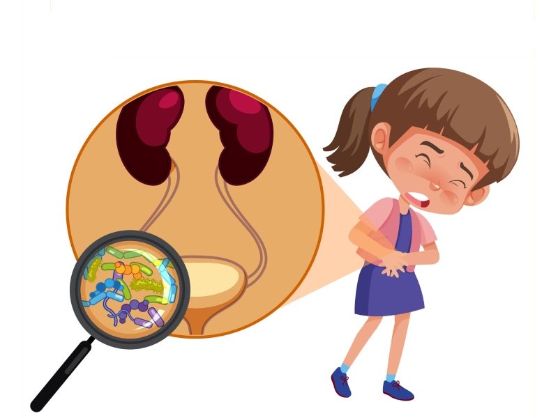 عفونت ادراری در کودکان: نشانه‌ ها، خطرات و راهکارهای پیشگیری