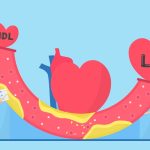 ارتباط بین سطح پایین LDL و افزایش خطر دیابت نوع ۲: یافته‌ های جدید