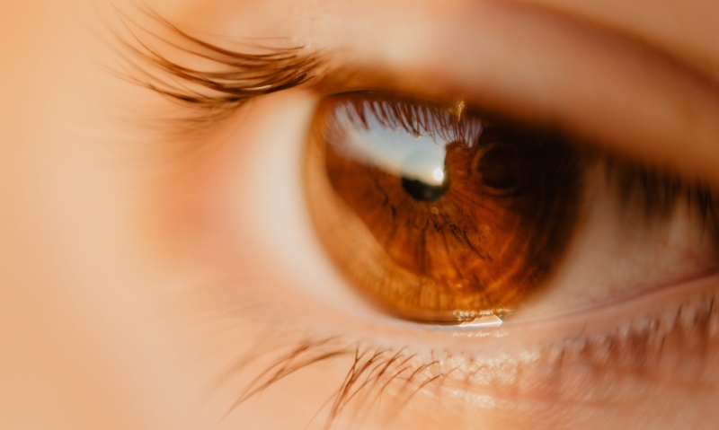 شیوع بالای آب سیاه مادرزادی در ایران و نقش ازدواج‌ های فامیلی