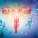 نفخ مداوم در زنان: نشانه‌ ای هشدار دهنده از سرطان تخمدان