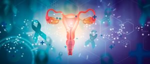 نفخ مداوم در زنان: نشانه‌ ای هشدار دهنده از سرطان تخمدان