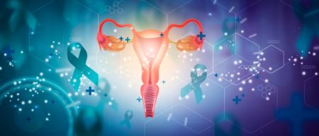 نفخ مداوم در زنان: نشانه‌ ای هشدار دهنده از سرطان تخمدان