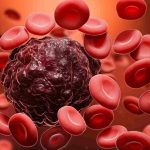 سرطان و نقش پنهان لخته‌ های خون در مرگ