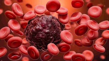 سرطان و نقش پنهان لخته‌ های خون در مرگ