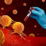 ژن‌ درمانی سرطان خون: روش نوینی که سلول‌ های سرطانی را ریشه‌ کن می‌ کند