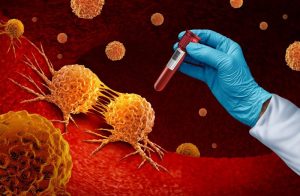 ژن‌ درمانی سرطان خون: روش نوینی که سلول‌ های سرطانی را ریشه‌ کن می‌ کند