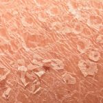 ۱۲ علت شایع پوسته‌ پوسته شدن پوست + پیشگیری و درمان