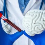 تحول در تشخیص آلزایمر: پیش بینی آغاز علائم با آزمایش خون