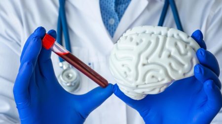 تحول در تشخیص آلزایمر: پیش بینی آغاز علائم با آزمایش خون