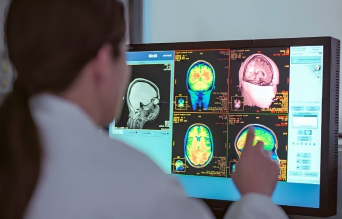 روش‌ ها و فناوری‌ های نوین در تشخیص اختلالات مغزی