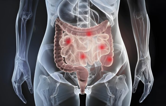 محدود کردن بازه زمانی غذا خوردن: رویکردی نوین در کنترل بیماری کرون