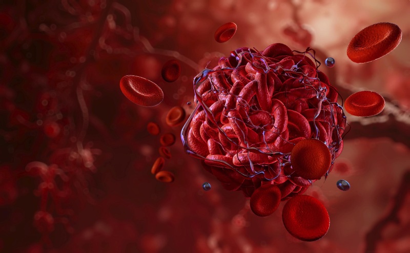 چرا این عارضه بسیار نادر باقی مانده است؟