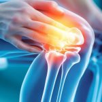 چگونه حرکت و فعالیت بدنی می‌ تواند پیشرفت آرتروز را متوقف کند؟