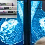 داروهای لاغری GLP-1 چگونه خطر سرطان پستان را کاهش می دهند؟