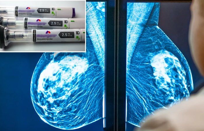 داروهای لاغری GLP-1 چگونه خطر سرطان پستان را کاهش می دهند؟