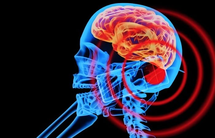 آیا امواج موبایل باعث سرطان مغز می شوند؟ جدیدترین تحقیقات علمی چه می گویند؟