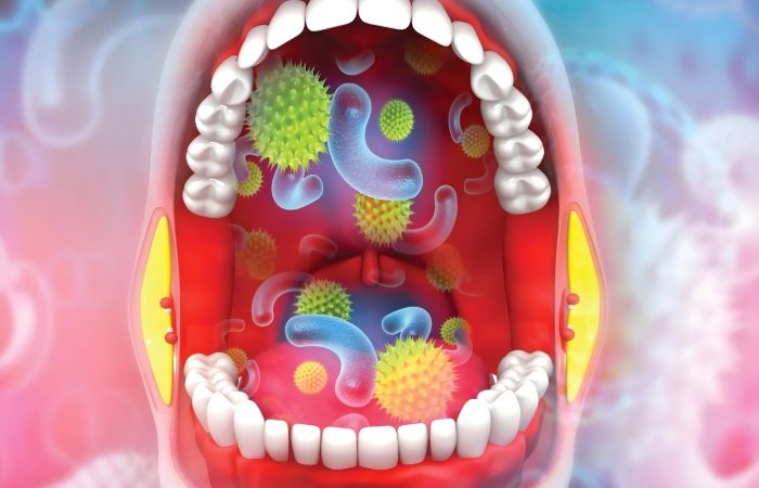 تشخیص سرطان روده با بررسی باکتری های دهان؛ یافته جدید پژوهشگران